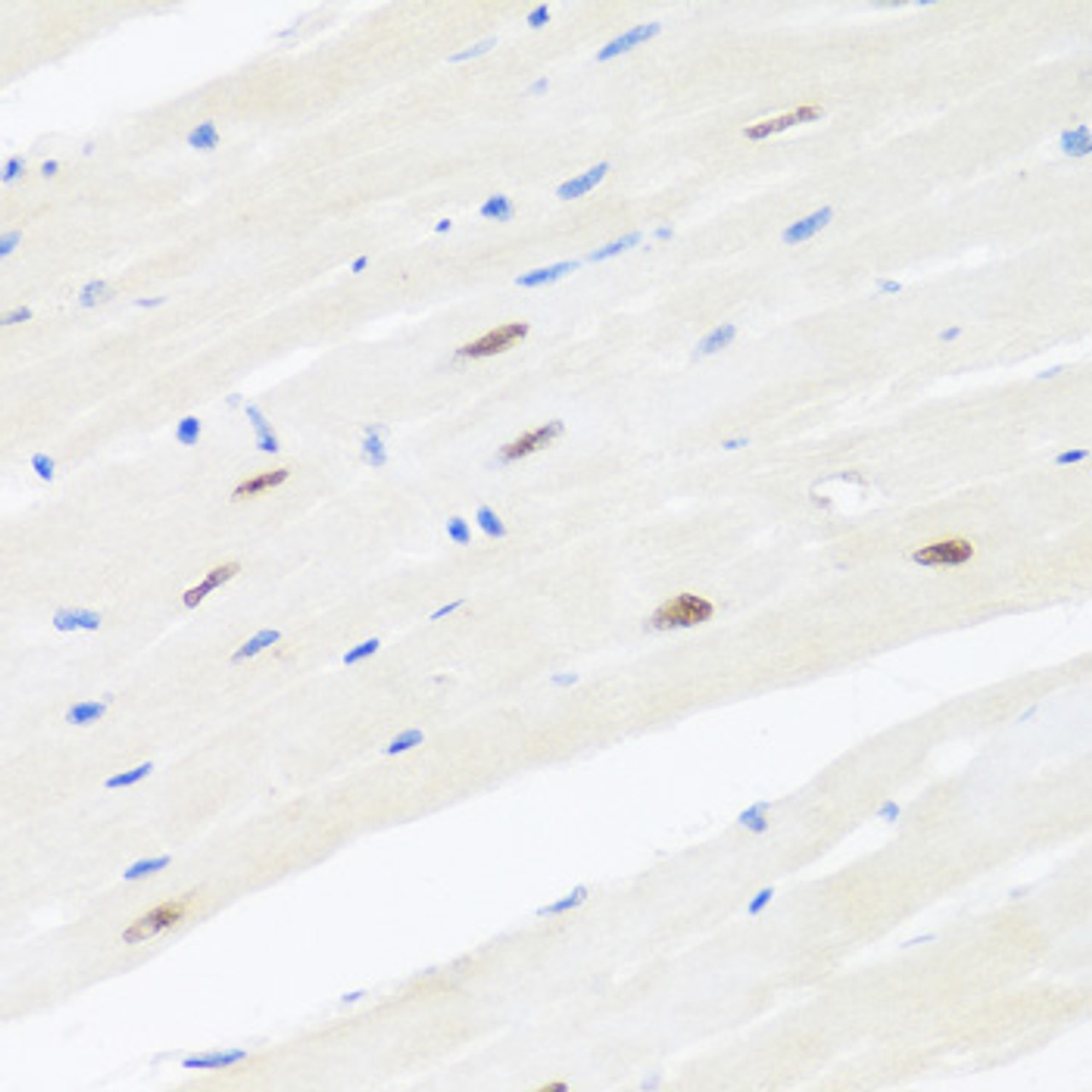Immunohistochemistry of paraffin-embedded Mouse heart using BRMS1 Polyclonal Antibody at dilution of  1:100 (40x lens).