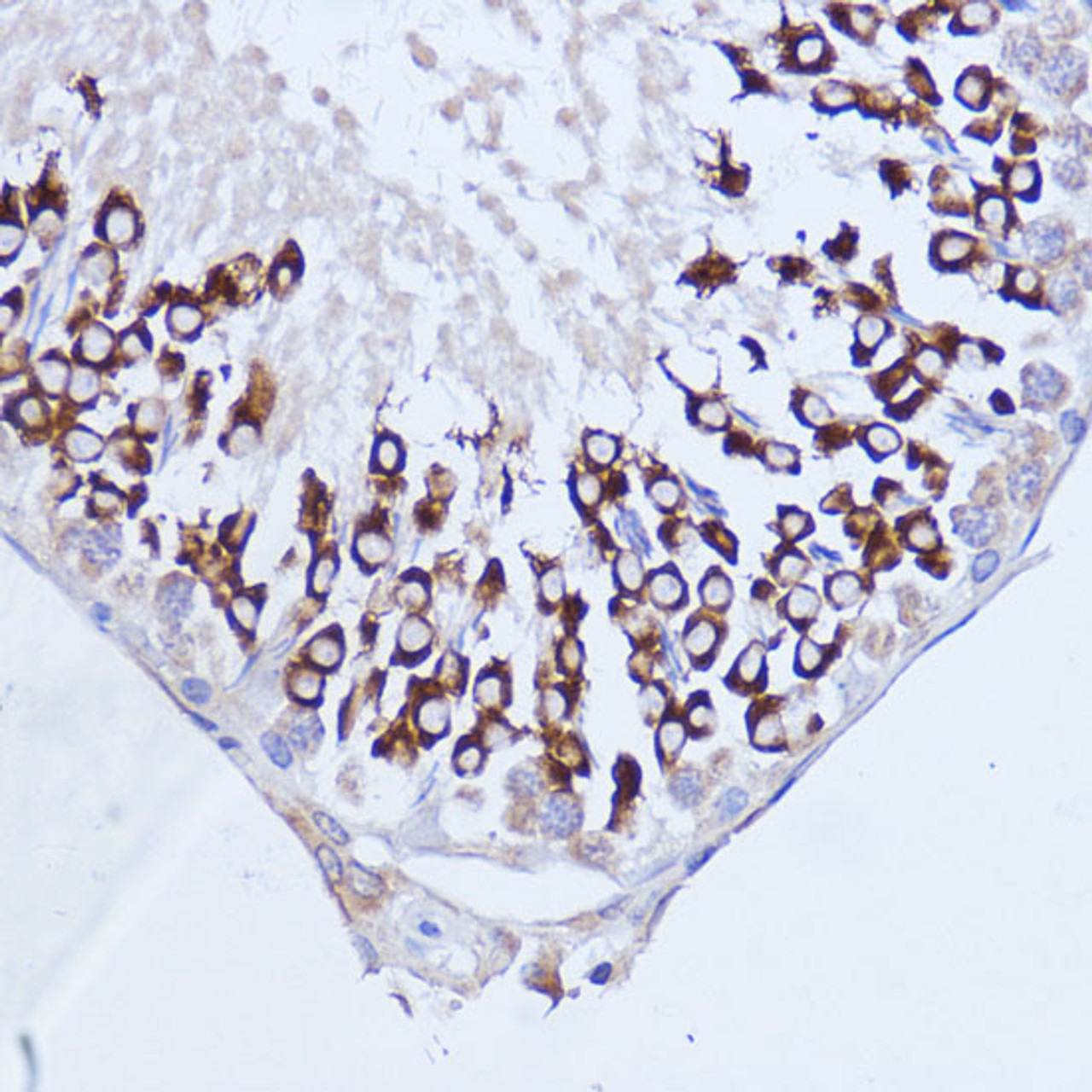 Immunohistochemistry of paraffin-embedded Rat testis using Polyclonal AntibodyPC1 Polyclonal Antibody at dilution of  1:100 (40x lens).