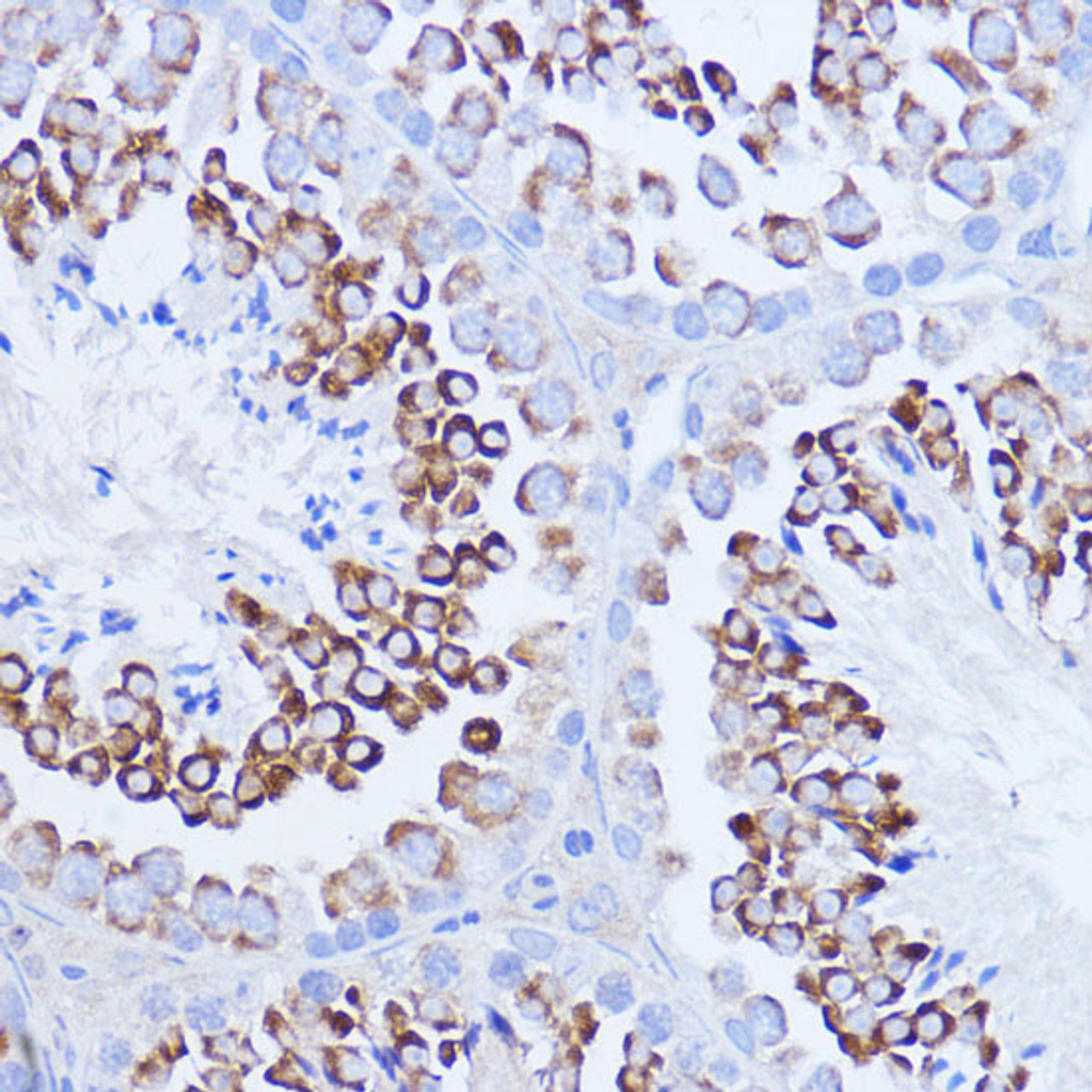 Immunohistochemistry of paraffin-embedded Mouse testis using Polyclonal AntibodyPC1 Polyclonal Antibody at dilution of  1:100 (40x lens).