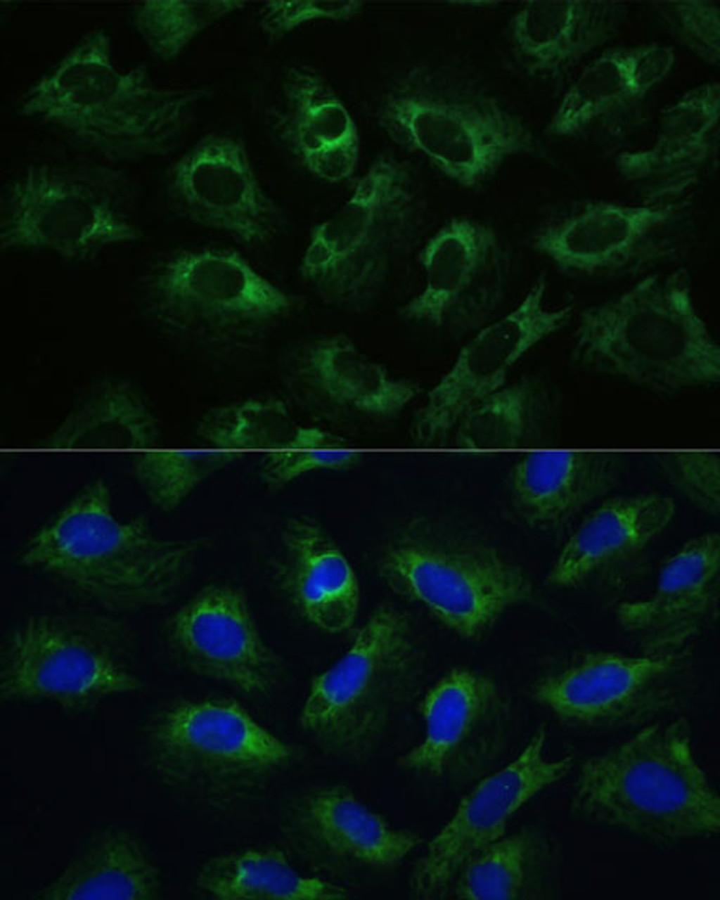 Immunofluorescence analysis of U-2 OS cells using Polyclonal AntibodyPC1 Polyclonal Antibody at dilution of  1:100 (40x lens). Blue: DAPI for nuclear staining.