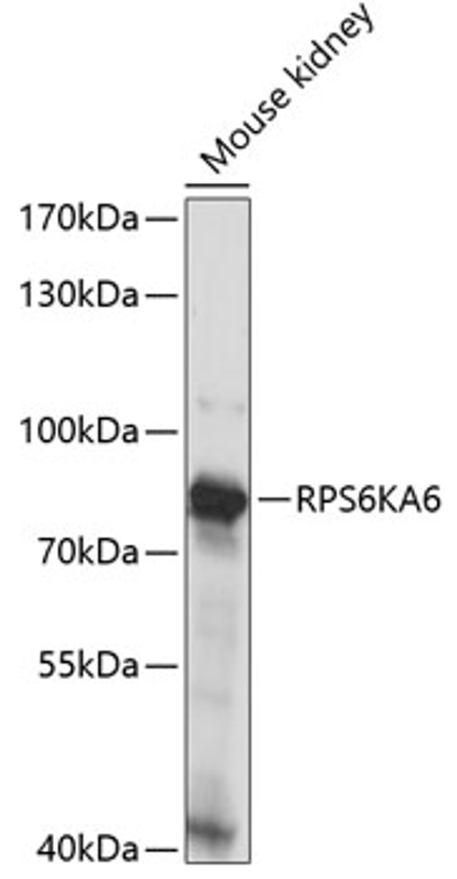 Western blot analysis of extracts of Mouse kidney using RPS6KA6 Polyclonal Antibody at dilution of 1:1000.