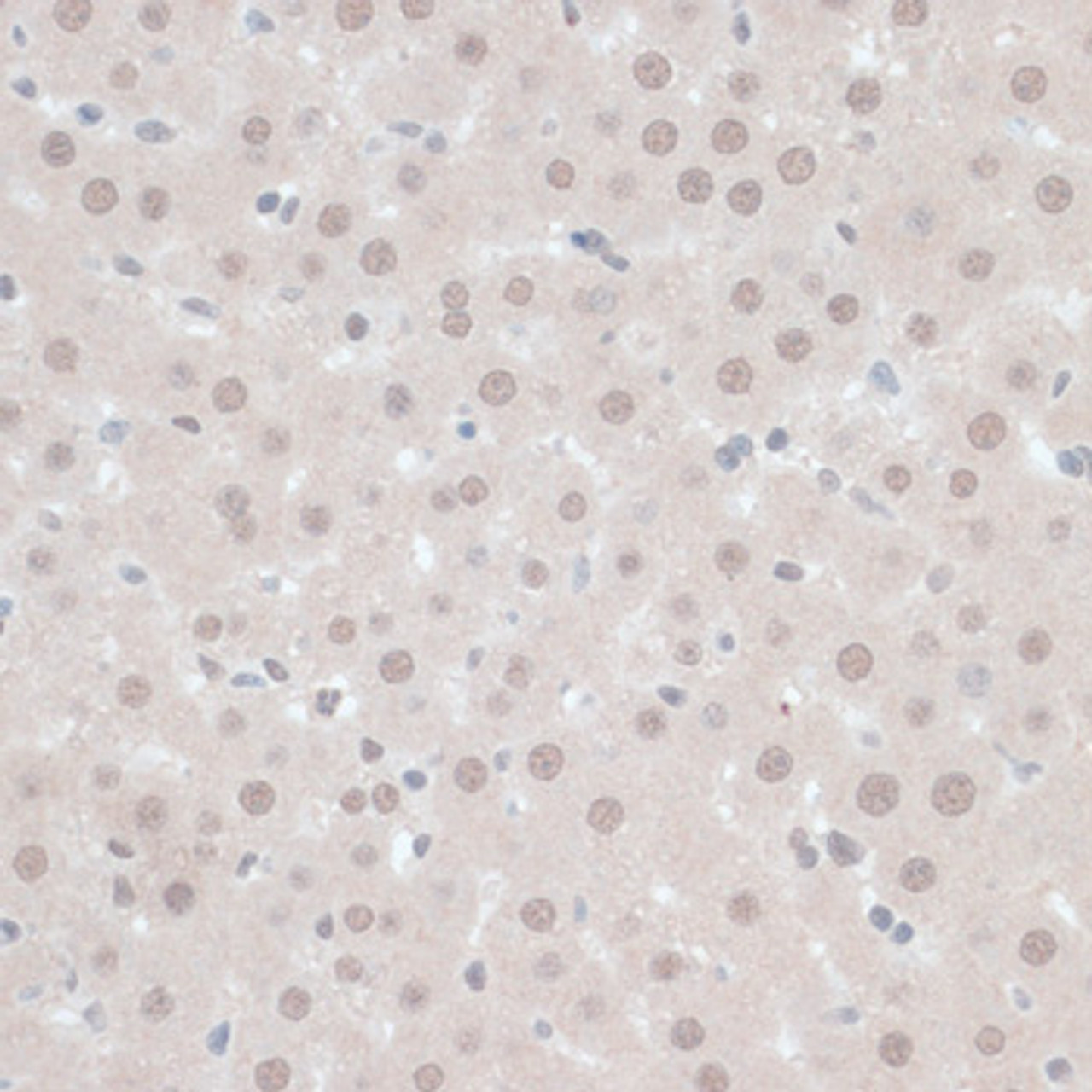 Immunohistochemistry of paraffin-embedded Rat liver using ZNF446 Polyclonal Antibody at dilution of  1:100 (40x lens).