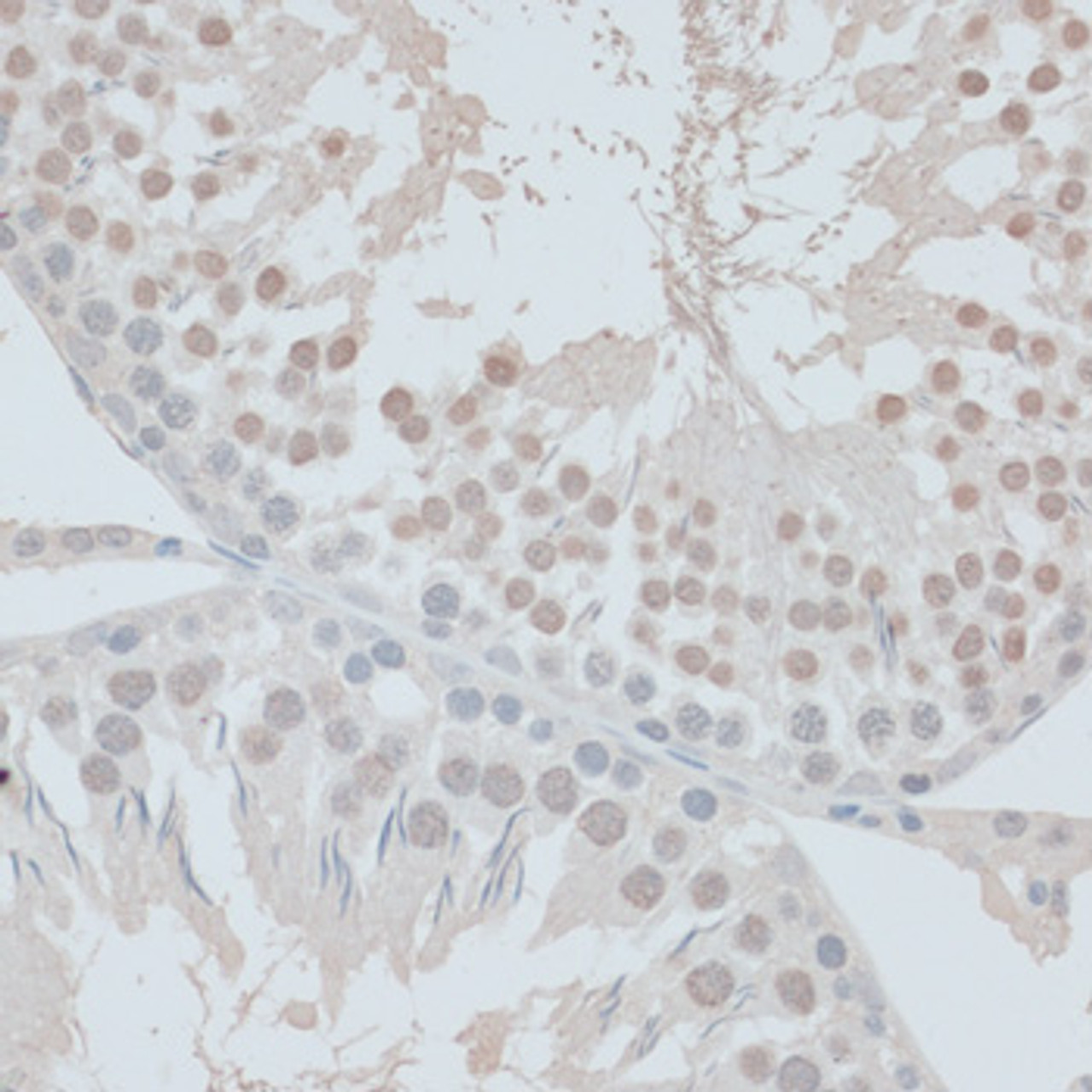 Immunohistochemistry of paraffin-embedded Rat testis using ZNF446 Polyclonal Antibody at dilution of  1:100 (40x lens).
