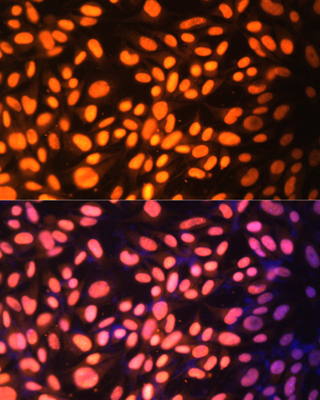 Immunofluorescence analysis of NIH-3T3 cells using ZNF446 Polyclonal Antibody at dilution of  1:100. Blue: DAPI for nuclear staining.