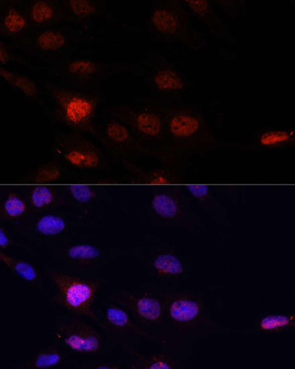 Immunofluorescence analysis of C6 cells using KLHL8 Polyclonal Antibody at dilution of  1:100. Blue: DAPI for nuclear staining.