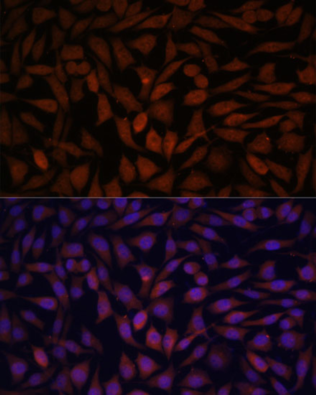 Immunofluorescence analysis of L929 cells using KLHL8 Polyclonal Antibody at dilution of  1:100. Blue: DAPI for nuclear staining.