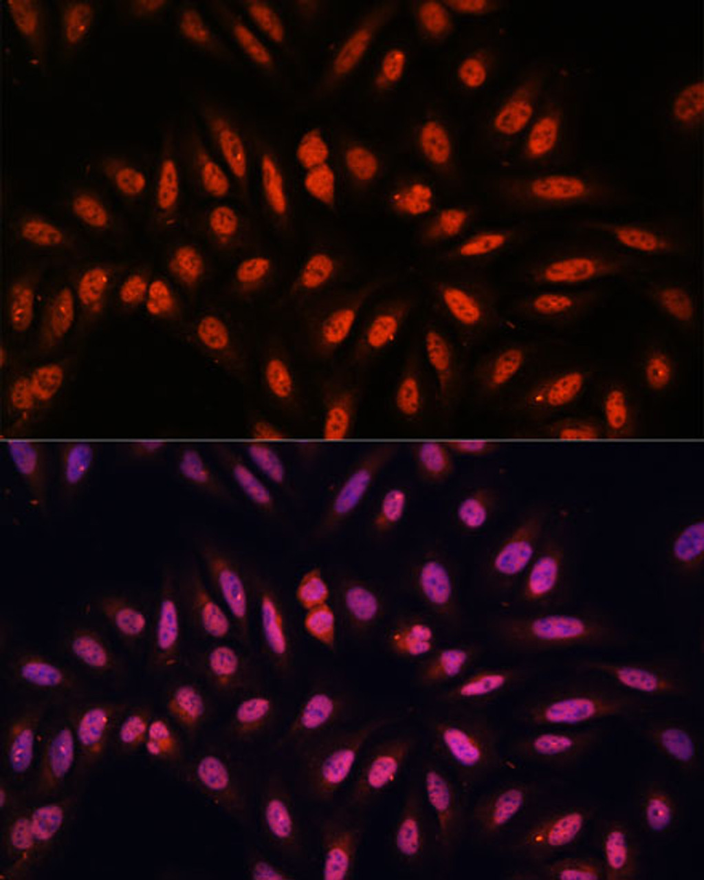 Immunofluorescence analysis of U-2 OS cells using KLHL8 Polyclonal Antibody at dilution of  1:100. Blue: DAPI for nuclear staining.
