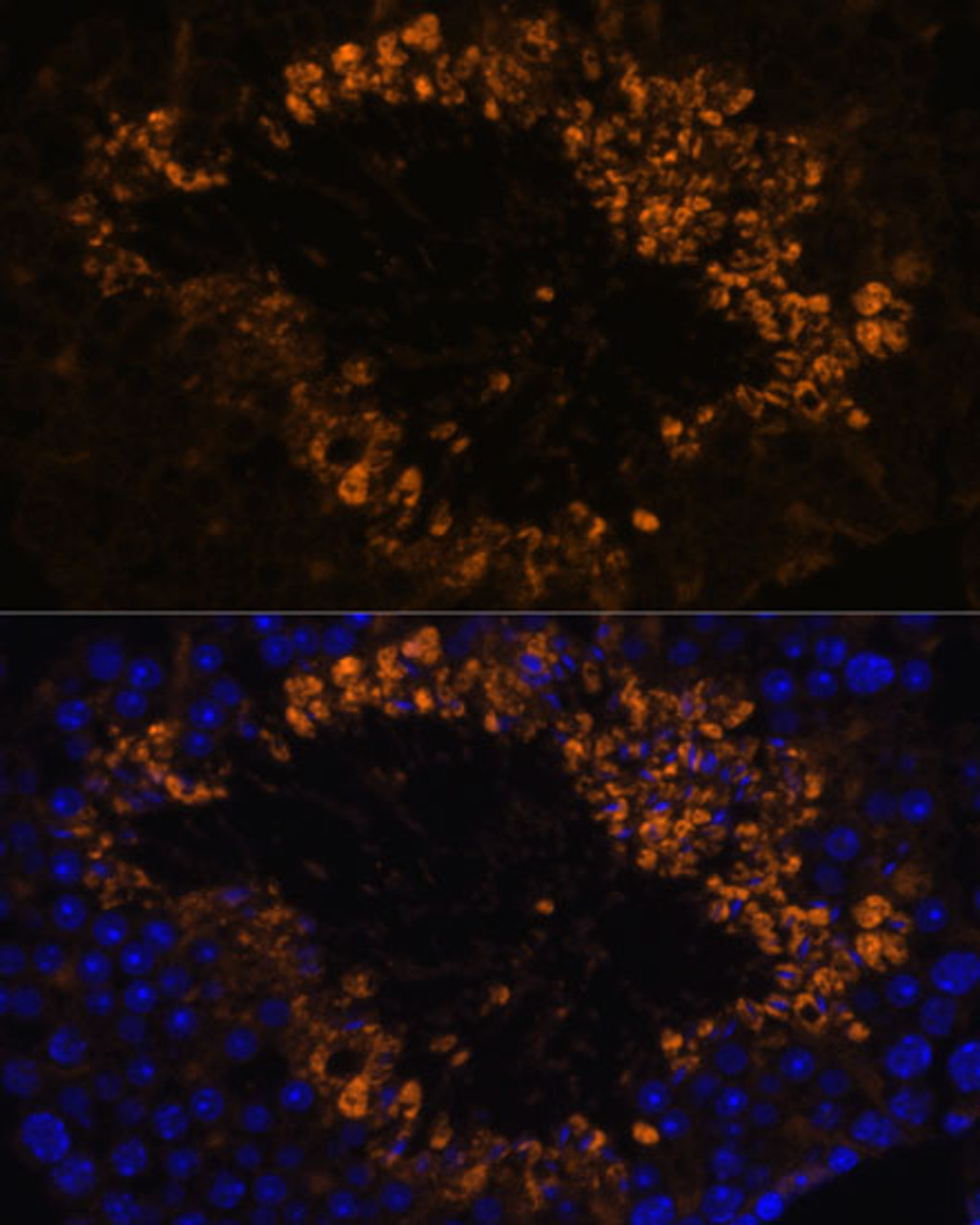 Immunofluorescence analysis of Mouse testis using OXCT2 Polyclonal Antibody at dilution of  1:100. Blue: DAPI for nuclear staining.