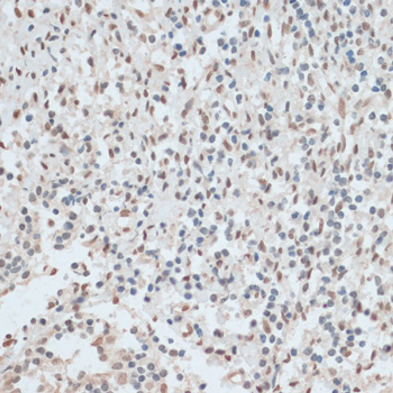 Immunohistochemistry of paraffin-embedded Human tonsil using ZNF574 Polyclonal Antibody at dilution of  1:100 (40x lens).