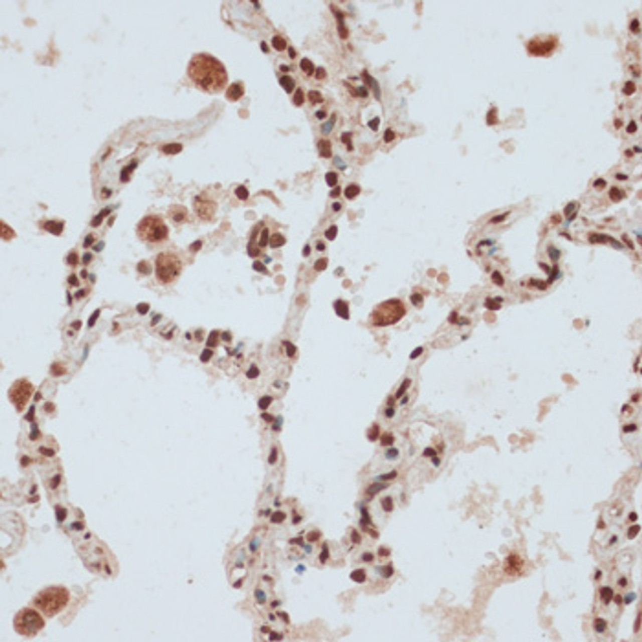 Immunohistochemistry of paraffin-embedded Human lung using ZNF574 Polyclonal Antibody at dilution of  1:100 (40x lens).