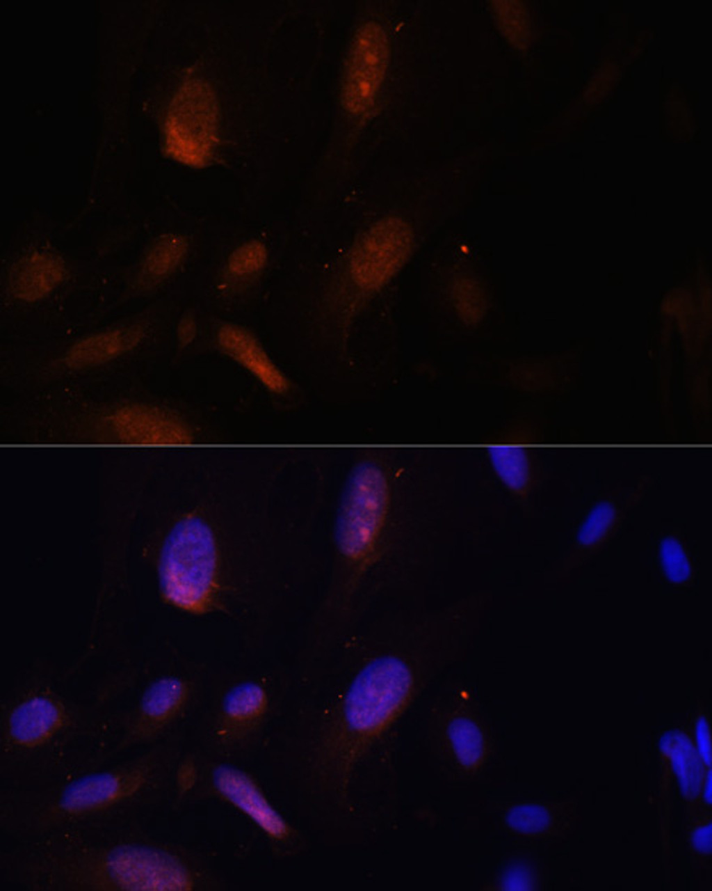 Immunofluorescence analysis of U-2 OS cells using ZNF574 Polyclonal Antibody at dilution of  1:100. Blue: DAPI for nuclear staining.