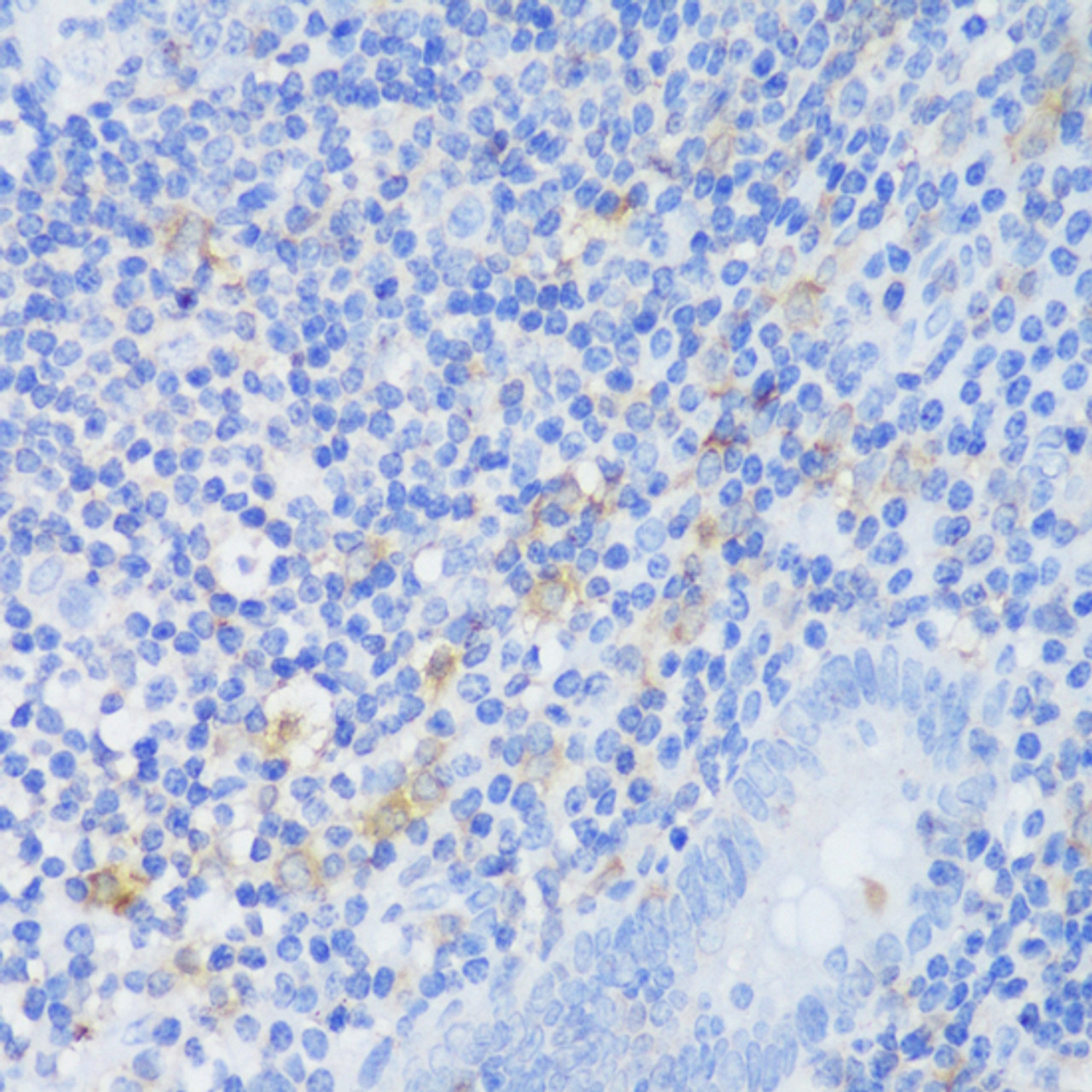 Immunohistochemistry of paraffin-embedded Human appendix using EFHD2 Polyclonal Antibody at dilution of  1:150 (40x lens).