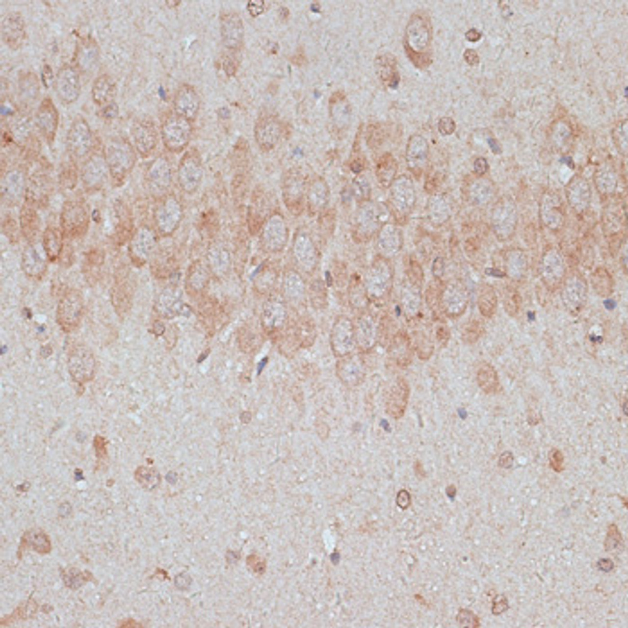 Immunohistochemistry of paraffin-embedded Rat brain using TMX1 Polyclonal Antibody at dilution of  1:100 (40x lens).