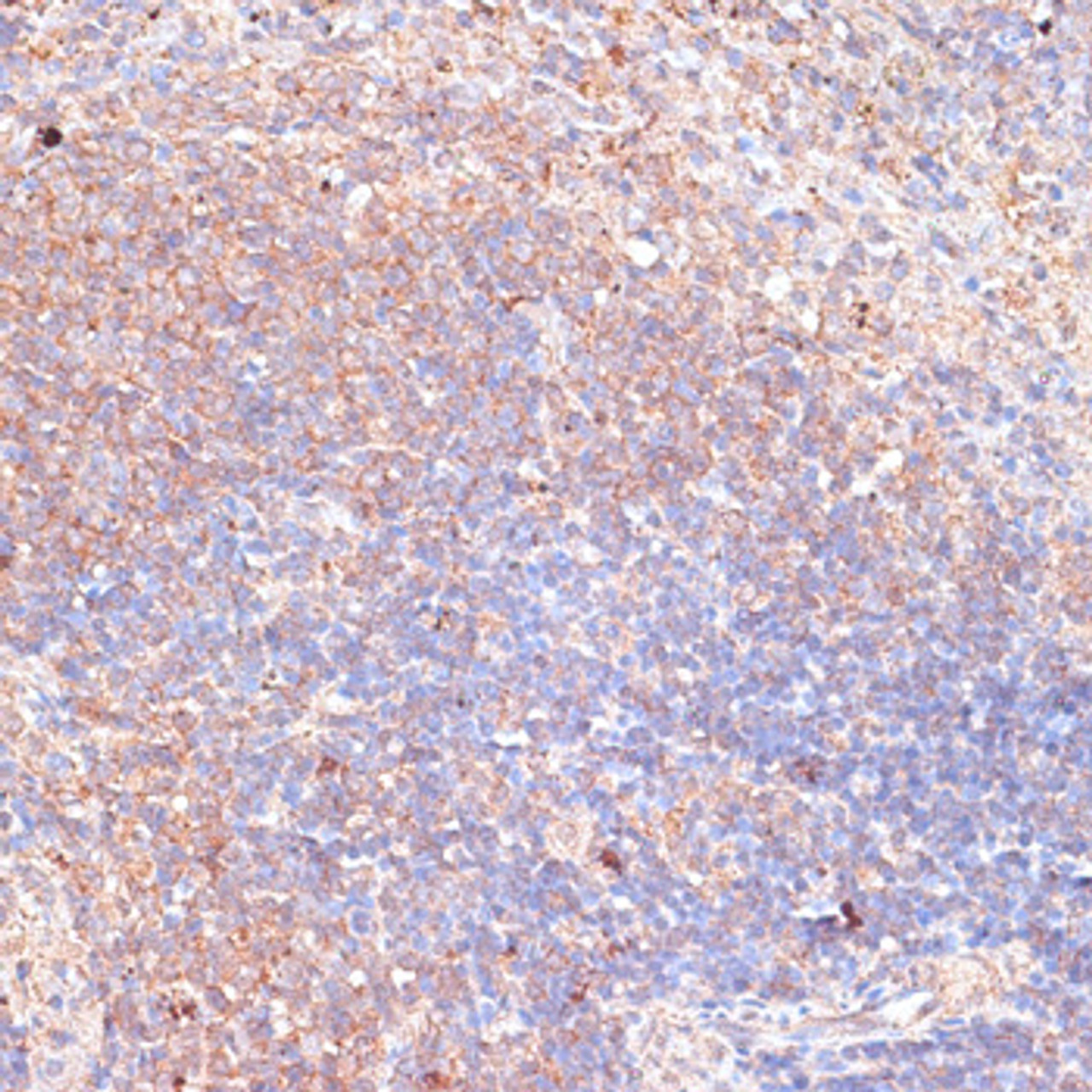 Immunohistochemistry of paraffin-embedded Mouse spleen using TMX1 Polyclonal Antibody at dilution of  1:100 (40x lens).