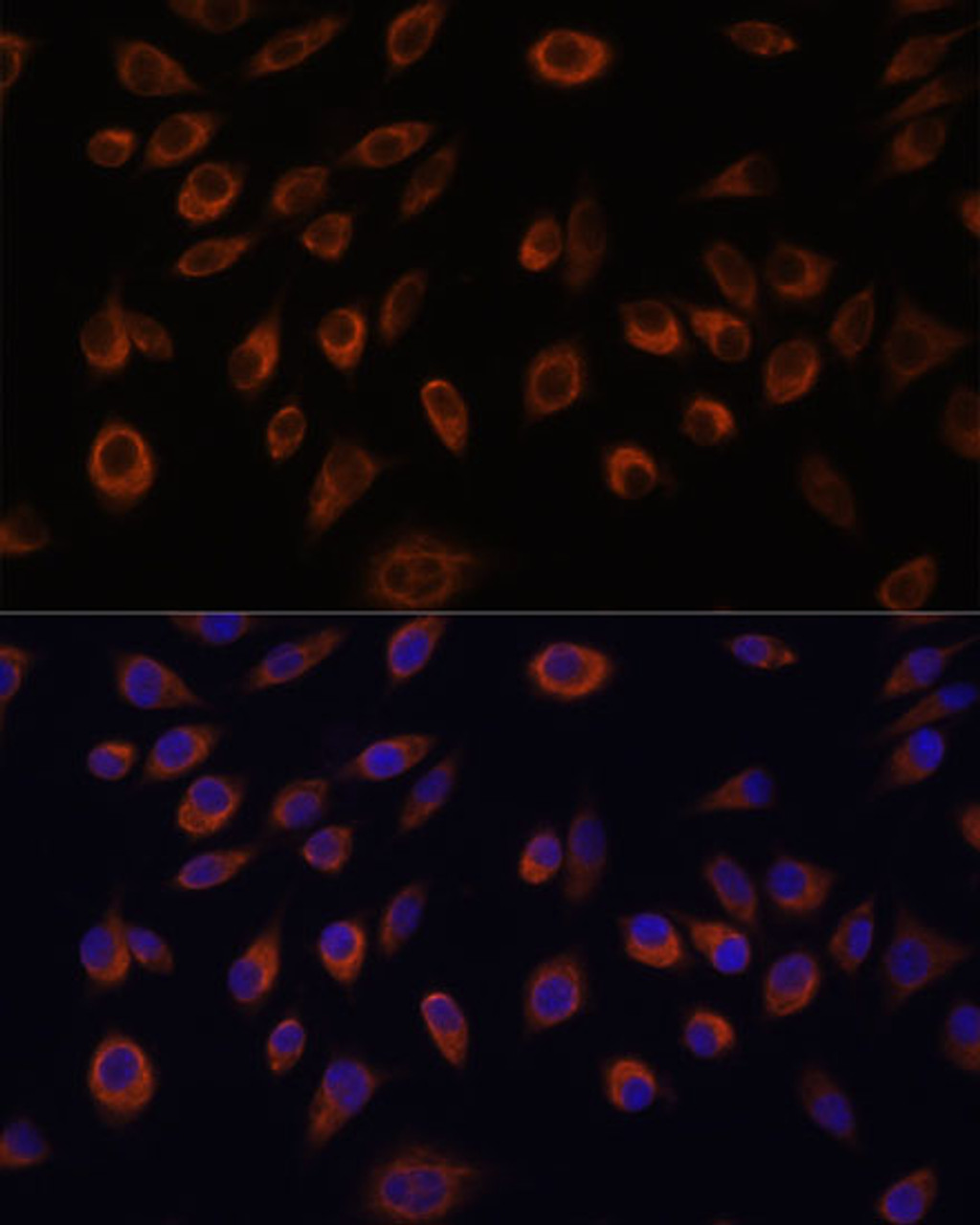 Immunofluorescence analysis of L929 cells using NTPCR Polyclonal Antibody at dilution of  1:100. Blue: DAPI for nuclear staining.