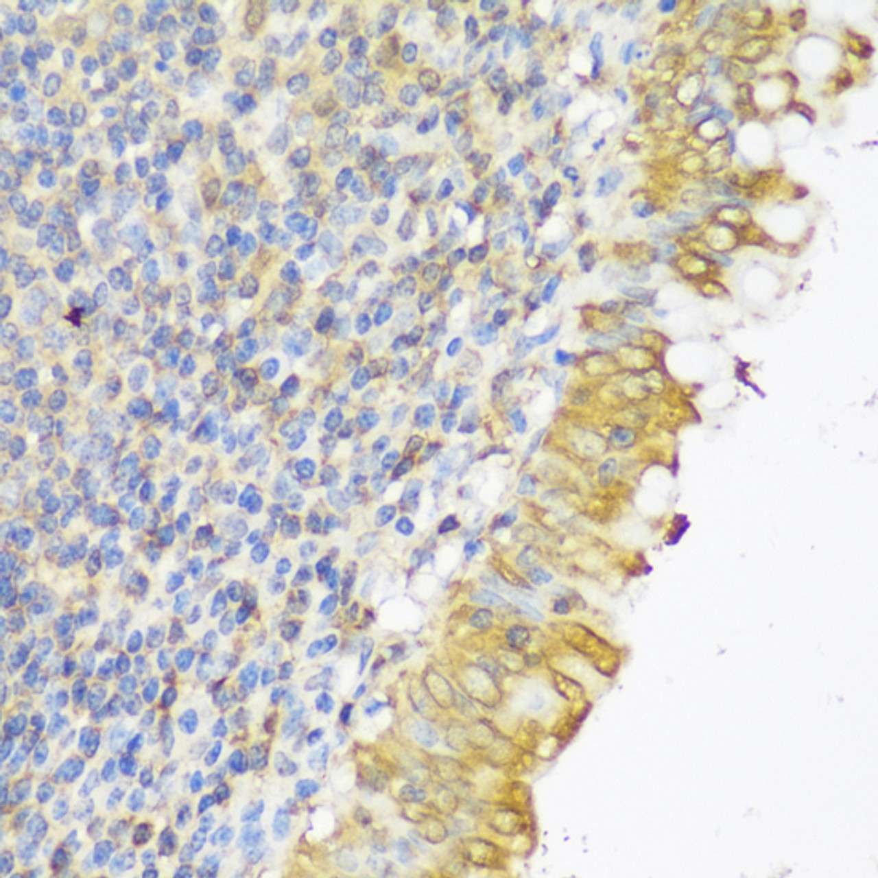 Immunohistochemistry of paraffin-embedded Human appendix using GLB1L3 Polyclonal Antibody at dilution of  1:150 (40x lens).