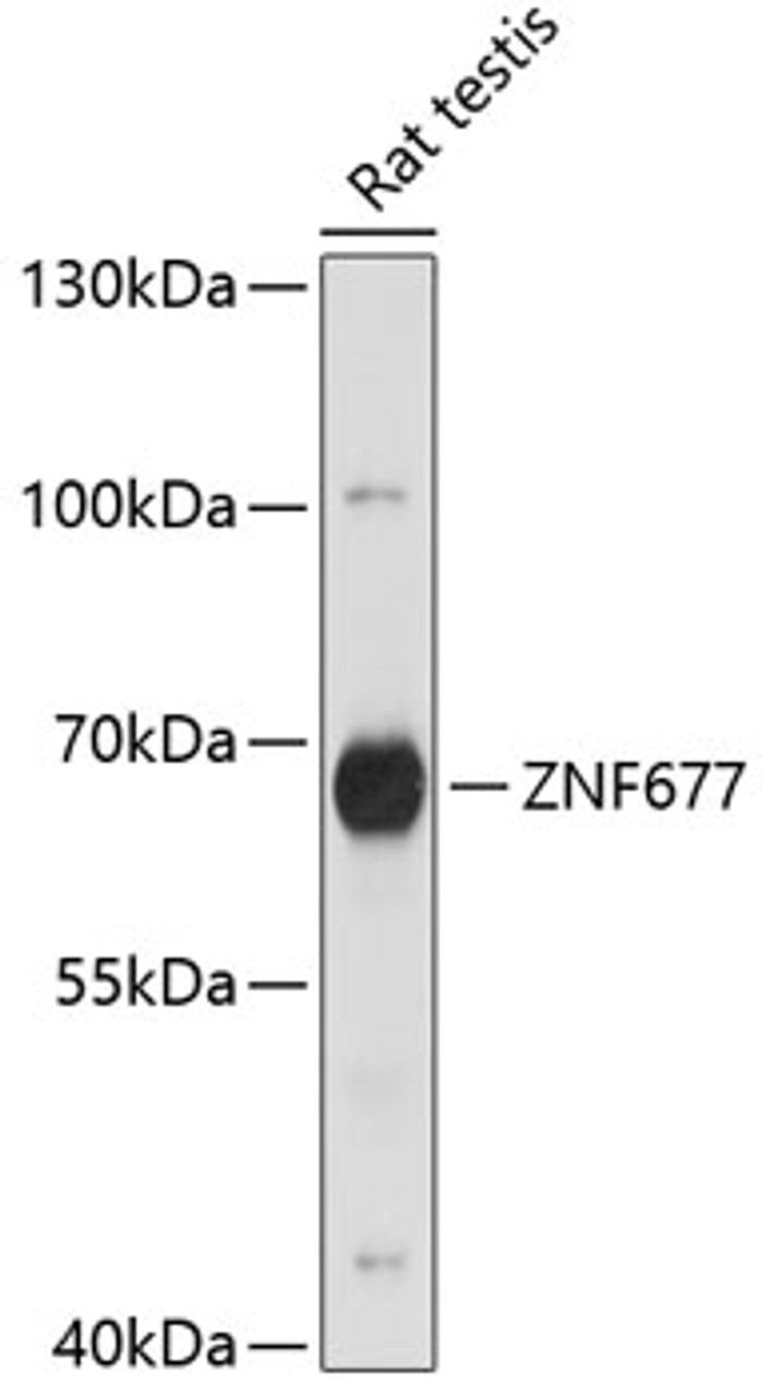 Western blot analysis of extracts of Rat testis using ZNF677 Polyclonal Antibody at dilution of 1:1000.