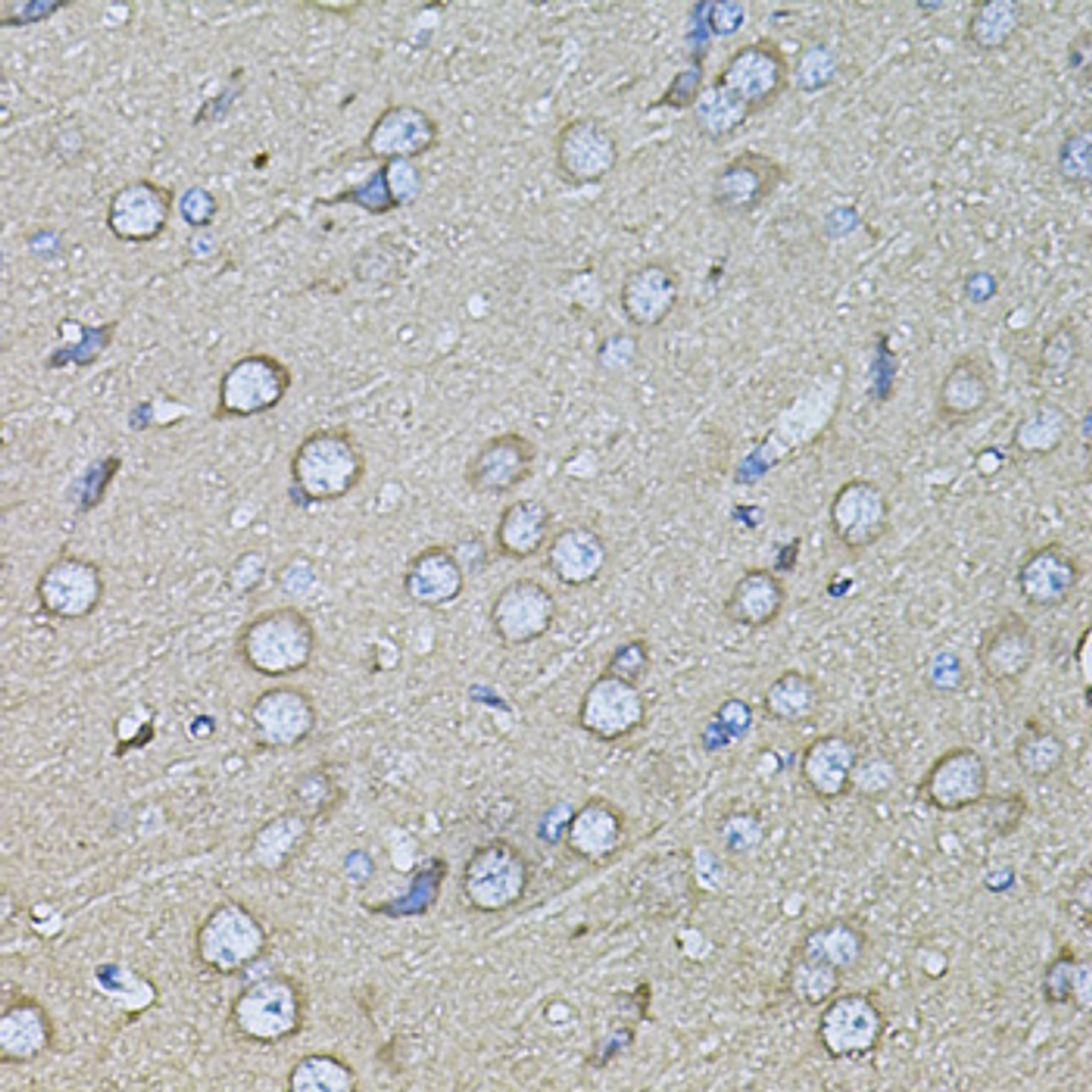 Immunohistochemistry of paraffin-embedded Rat brain using Osteopontin Polyclonal Antibody at dilution of  1:100 (40x lens).