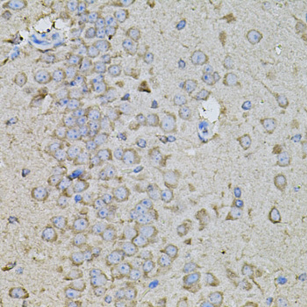 Immunohistochemistry of paraffin-embedded Mouse brain using Osteopontin Polyclonal Antibody at dilution of  1:100 (40x lens).