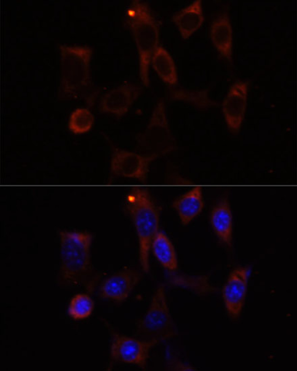 Immunofluorescence analysis of NIH/3T3 cells using YTHDC2 Polyclonal Antibody at dilution of  1:100. Blue: DAPI for nuclear staining.