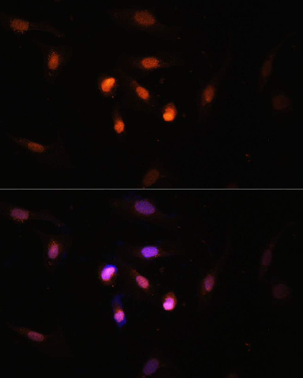 Immunofluorescence analysis of U2OS cells using KAT6A Polyclonal Antibody at dilution of  1:100. Blue: DAPI for nuclear staining.