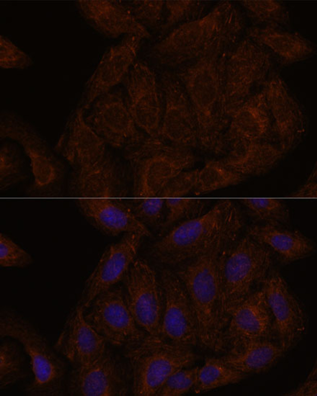 Immunofluorescence analysis of U-2 OS cells using SEPT8 Polyclonal Antibody at dilution of  1:100. Blue: DAPI for nuclear staining.