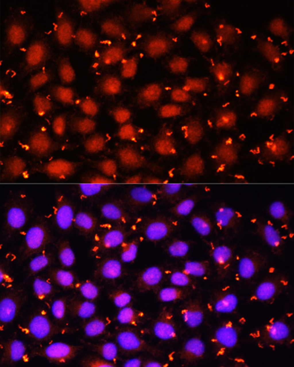 Immunofluorescence analysis of HeLa cells using ACAA1 Polyclonal Antibody at dilution of  1:100 (40x lens). Blue: DAPI for nuclear staining.