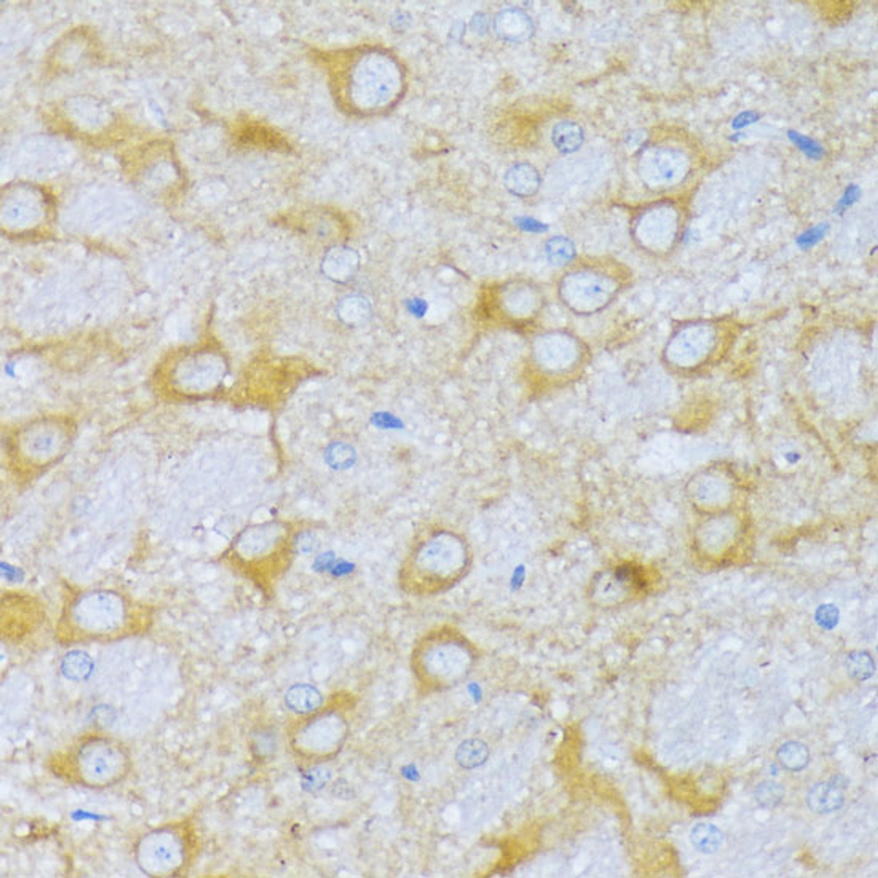 Immunohistochemistry of paraffin-embedded Rat brain using ACADSB Polyclonal Antibody at dilution of  1:100 (40x lens).