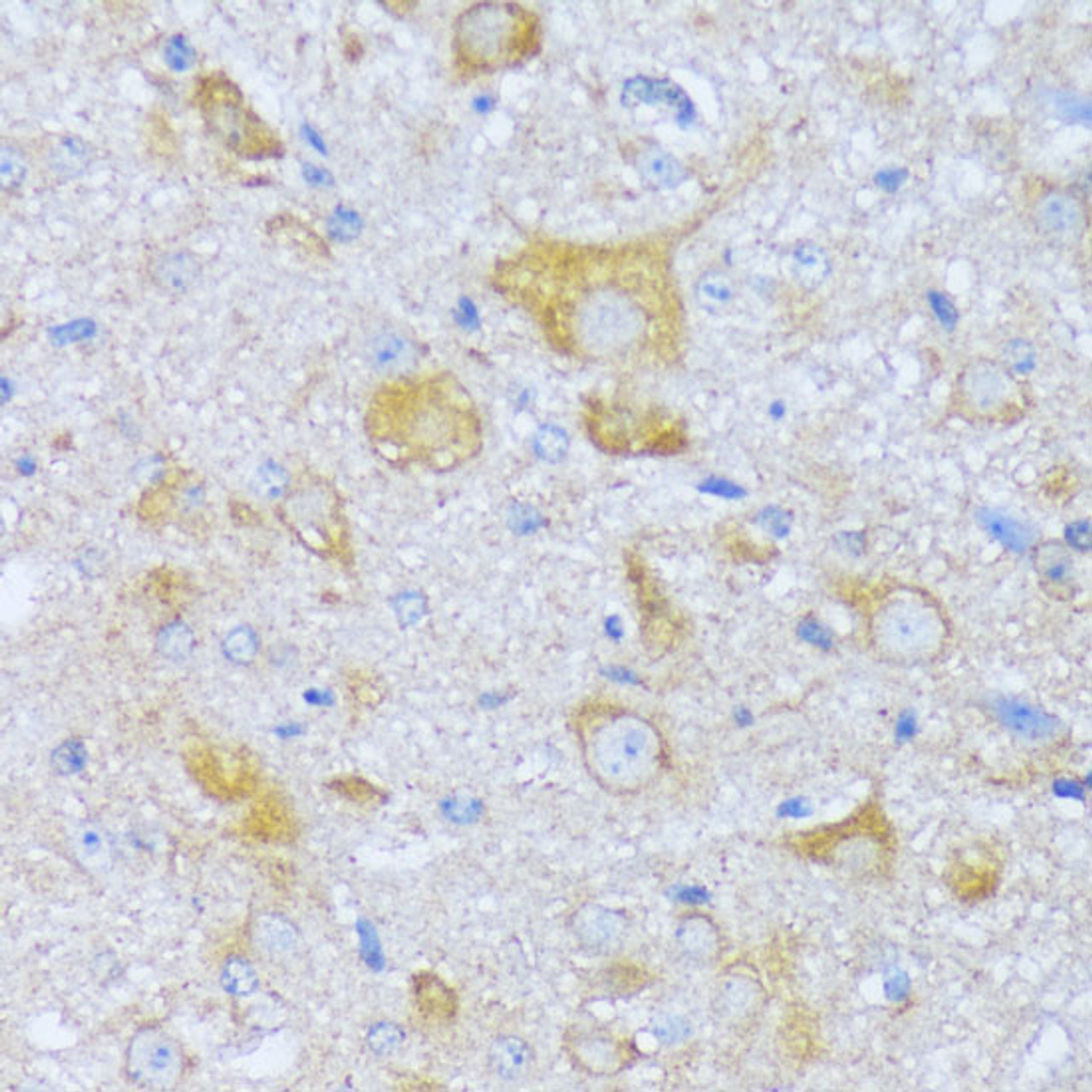 Immunohistochemistry of paraffin-embedded Mouse spinal cord using ACADSB Polyclonal Antibody at dilution of  1:100 (40x lens).