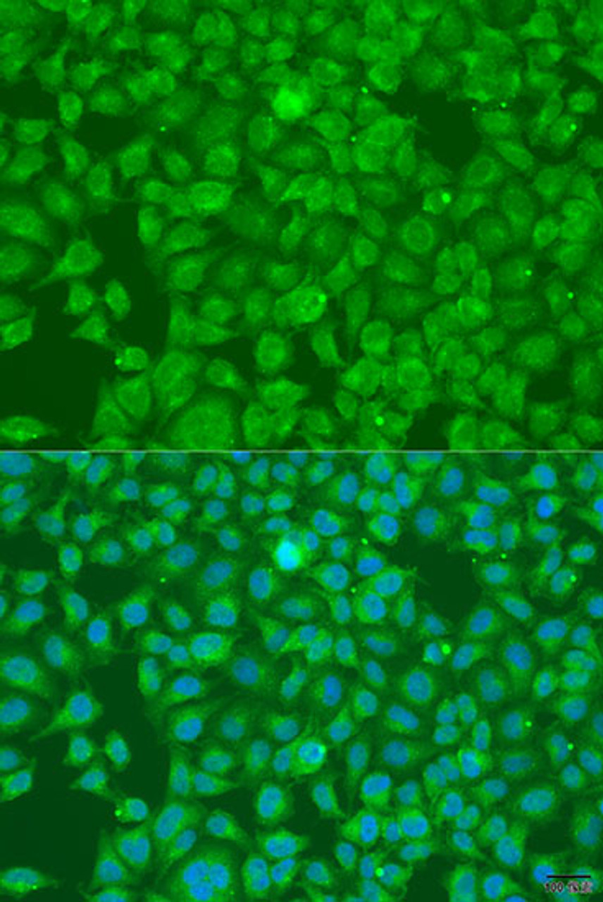 Immunofluorescence analysis of U2OS cells using SLC25A6 Polyclonal Antibody at dilution of  1:100. Blue: DAPI for nuclear staining.