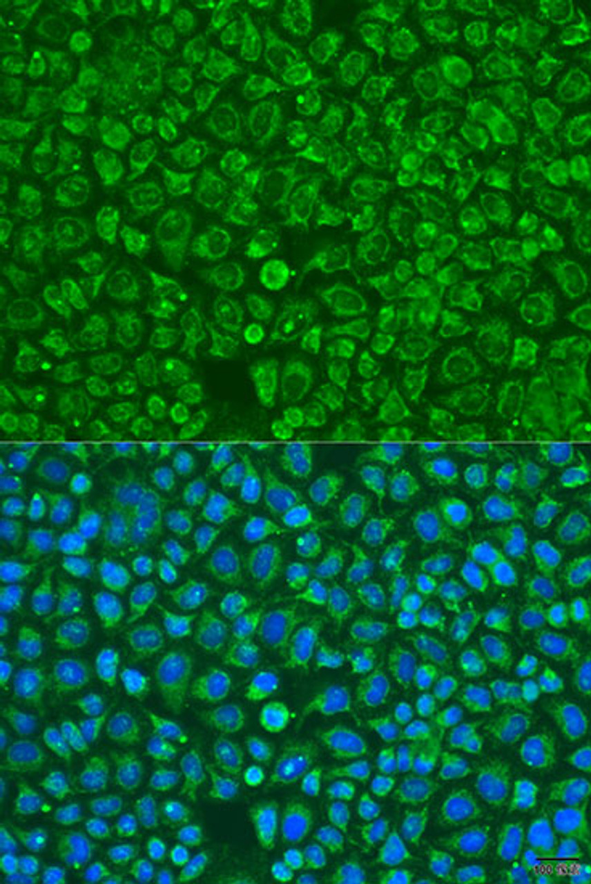 Immunofluorescence analysis of U2OS cells using ARSF Polyclonal Antibody at dilution of  1:100. Blue: DAPI for nuclear staining.