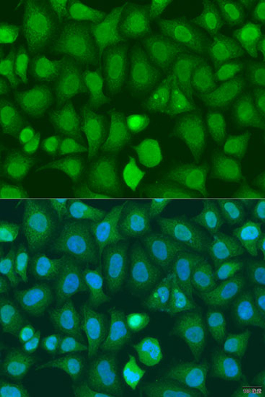 Immunofluorescence analysis of U2OS cells using CHD1 Polyclonal Antibody at dilution of  1:100. Blue: DAPI for nuclear staining.