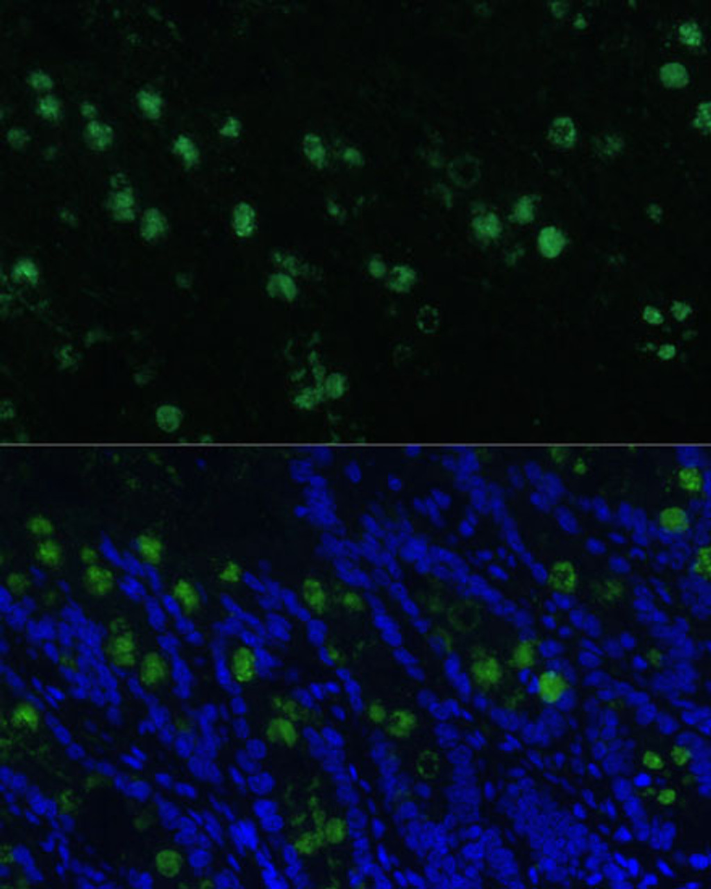Immunofluorescence analysis of Rat colon using CLCA1 Polyclonal Antibody at dilution of  1:100 (40x lens). Blue: DAPI for nuclear staining.