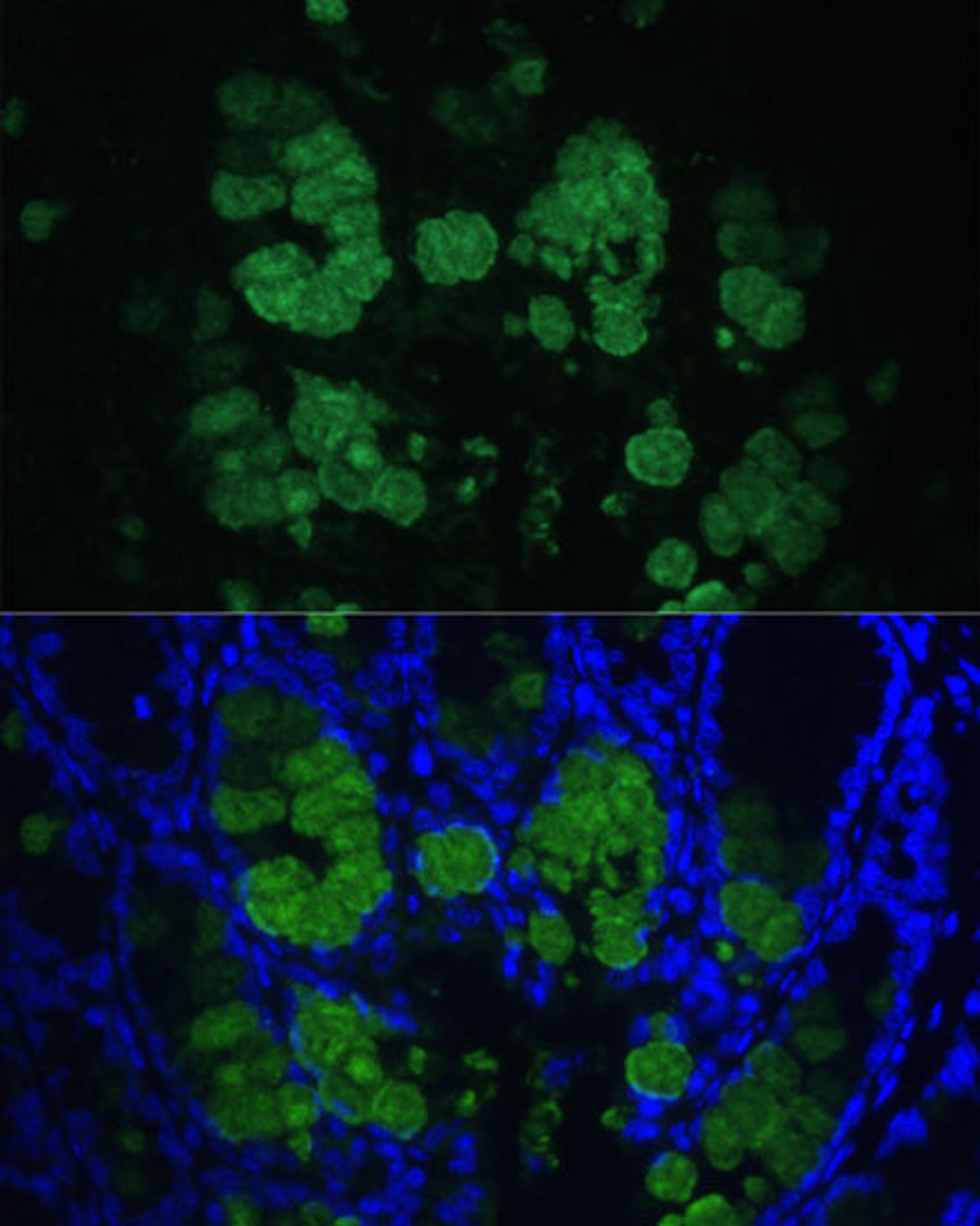 Immunofluorescence analysis of Mouse colon using CLCA1 Polyclonal Antibody at dilution of  1:100 (40x lens). Blue: DAPI for nuclear staining.