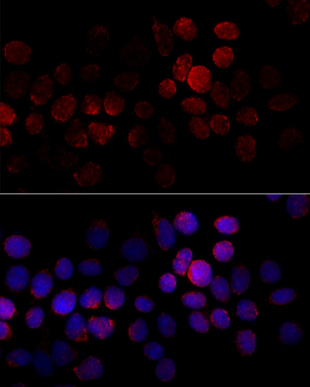 Immunofluorescence analysis of HeLa cells using CYP2J2 Polyclonal Antibody at dilution of  1:100 (40x lens). Blue: DAPI for nuclear staining.