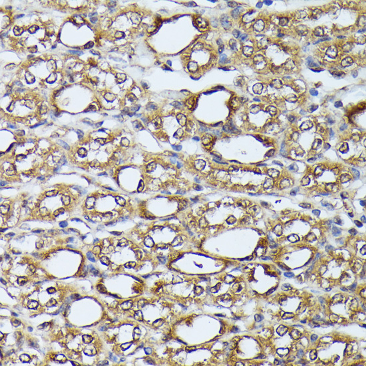 Immunohistochemistry of paraffin-embedded Mouse kidney using DAPK3 Polyclonal Antibody at dilution of  1:100 (40x lens).