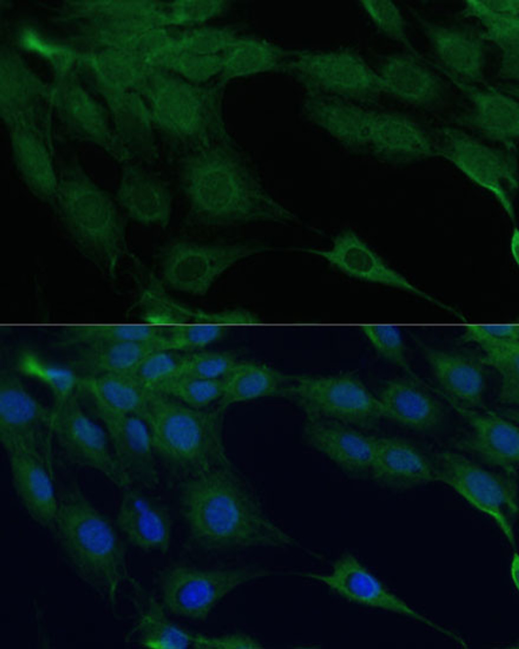 Immunofluorescence analysis of C6 cells using DAPK3 Polyclonal Antibody at dilution of  1:100 (40x lens). Blue: DAPI for nuclear staining.