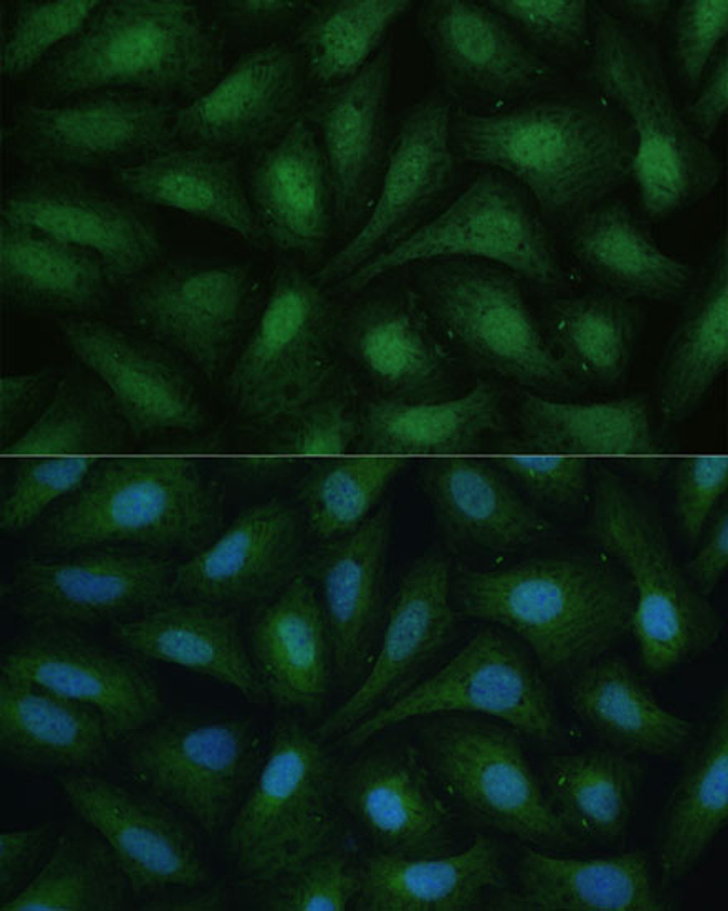 Immunofluorescence analysis of U-2 OS cells using DAPK3 Polyclonal Antibody at dilution of  1:100 (40x lens). Blue: DAPI for nuclear staining.