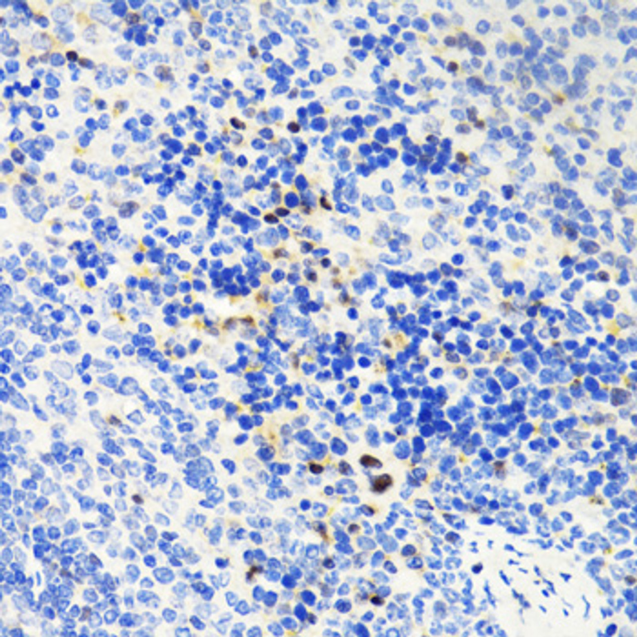 Immunohistochemistry of paraffin-embedded Mouse spleen using TET1 Polyclonal Antibody at dilution of  1:100 (40x lens).