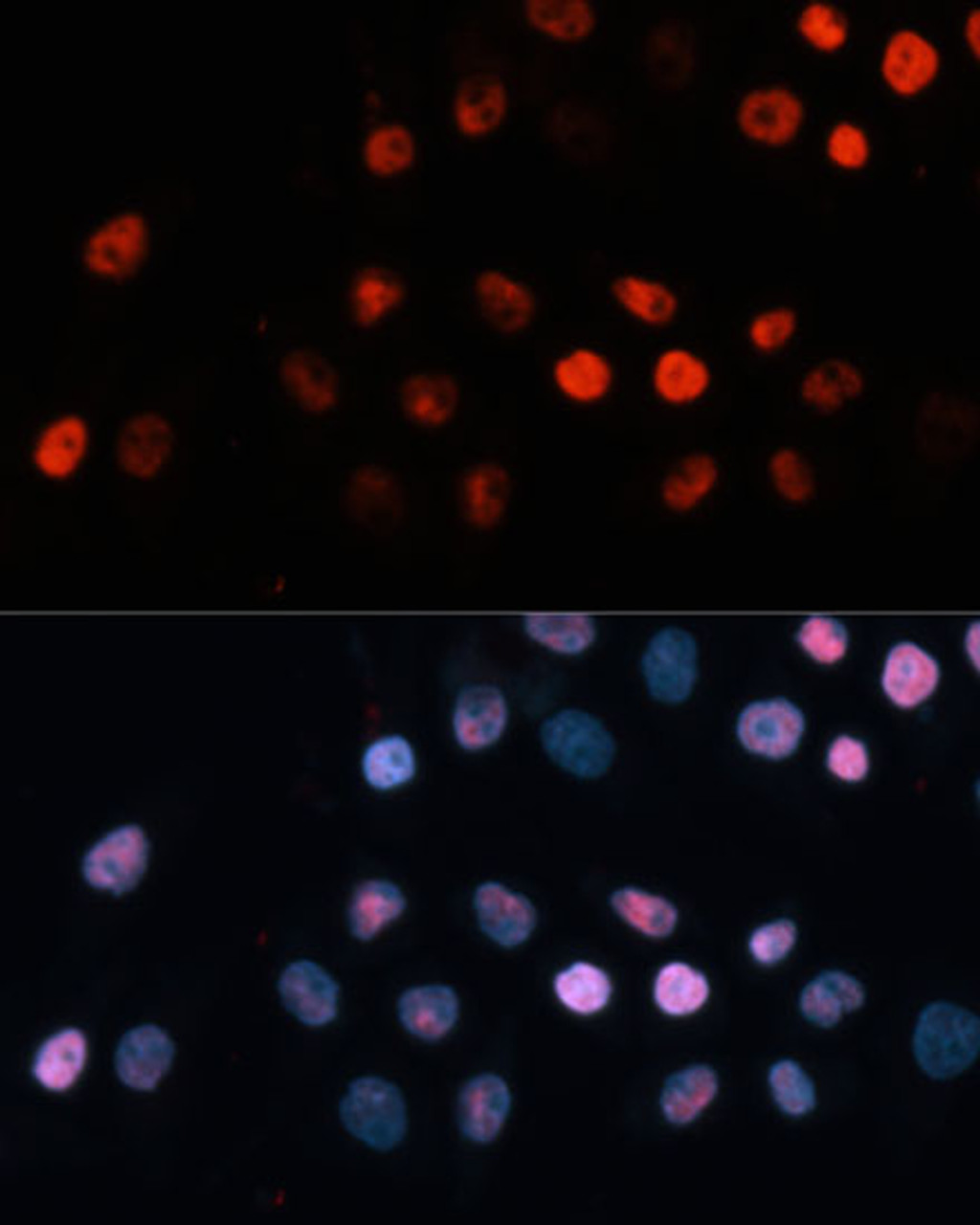 Immunofluorescence analysis of HeLa cells using TET1 Polyclonal Antibody at dilution of  1:100 (40x lens). Blue: DAPI for nuclear staining.