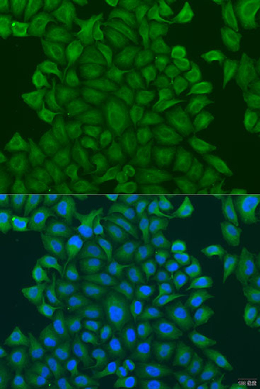 Immunofluorescence analysis of U2OS cells using GSTM3 Polyclonal Antibody at dilution of  1:100. Blue: DAPI for nuclear staining.