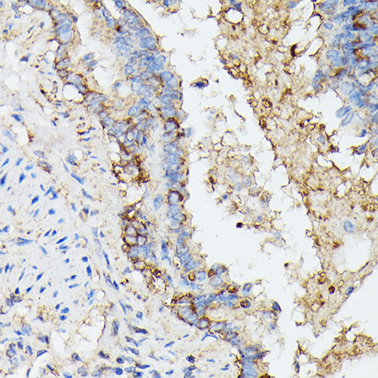 Immunohistochemistry of paraffin-embedded Rat lung using KRT14 Polyclonal Antibody at dilution of  1:100 (40x lens).