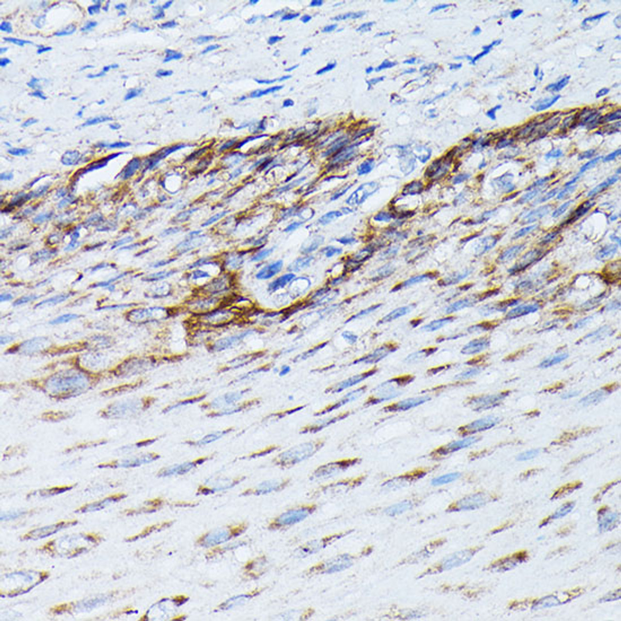 Immunohistochemistry of paraffin-embedded Human esophagus using KRT14 Polyclonal Antibody at dilution of  1:100 (40x lens).