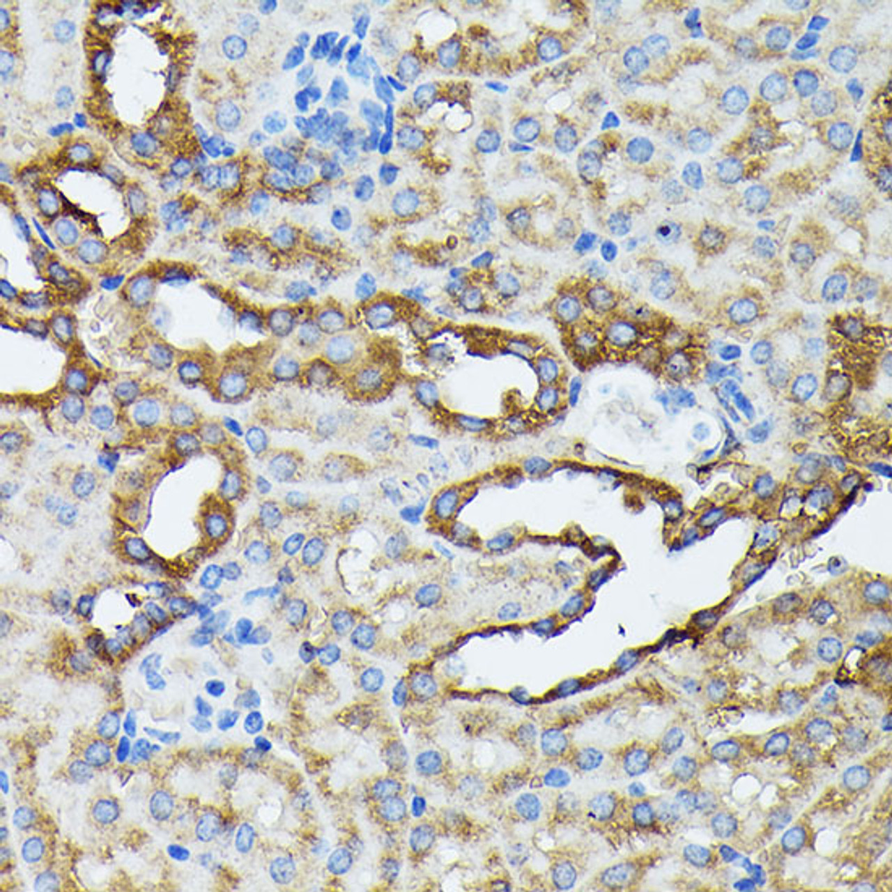 Immunohistochemistry of paraffin-embedded Mouse kidney using KRT14 Polyclonal Antibody at dilution of  1:100 (40x lens).