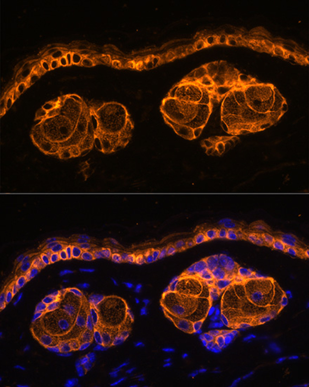 Immunofluorescence analysis of Mouse skin using KRT14 Polyclonal Antibody at dilution of  1:100. Blue: DAPI for nuclear staining.