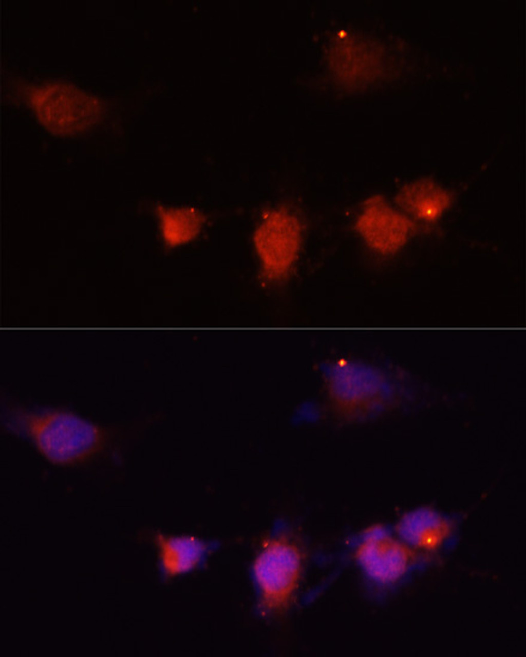 Immunofluorescence analysis of U-251MG cells using NPY Polyclonal Antibody at dilution of  1:100 (40x lens). Blue: DAPI for nuclear staining.