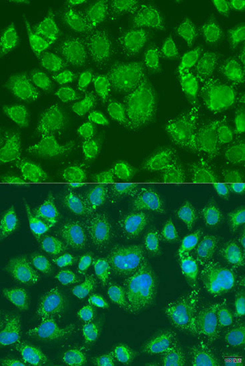 Immunofluorescence analysis of U2OS cells using PFKL Polyclonal Antibody at dilution of  1:100. Blue: DAPI for nuclear staining.