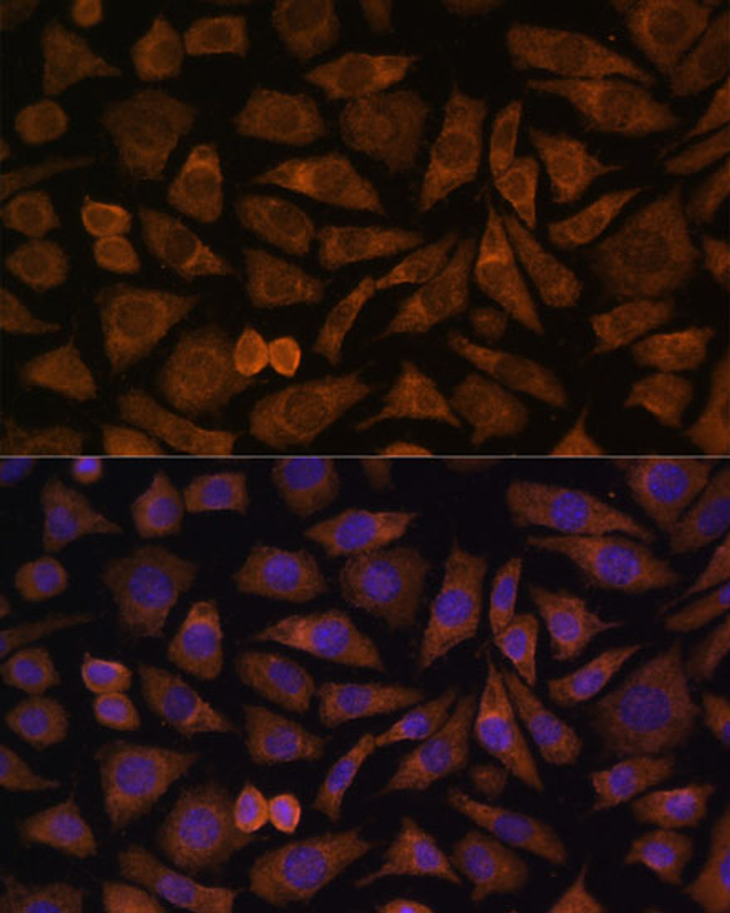 Immunofluorescence analysis of L929 cells using RABIF Polyclonal Antibody at dilution of  1:100 (40x lens). Blue: DAPI for nuclear staining.