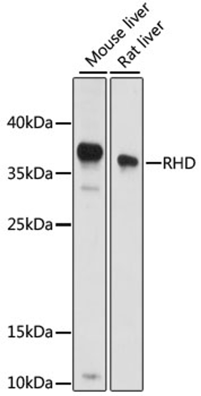 Western blot analysis of extracts of various cell lines using RHD Polyclonal Antibody at dilution of 1:1000.