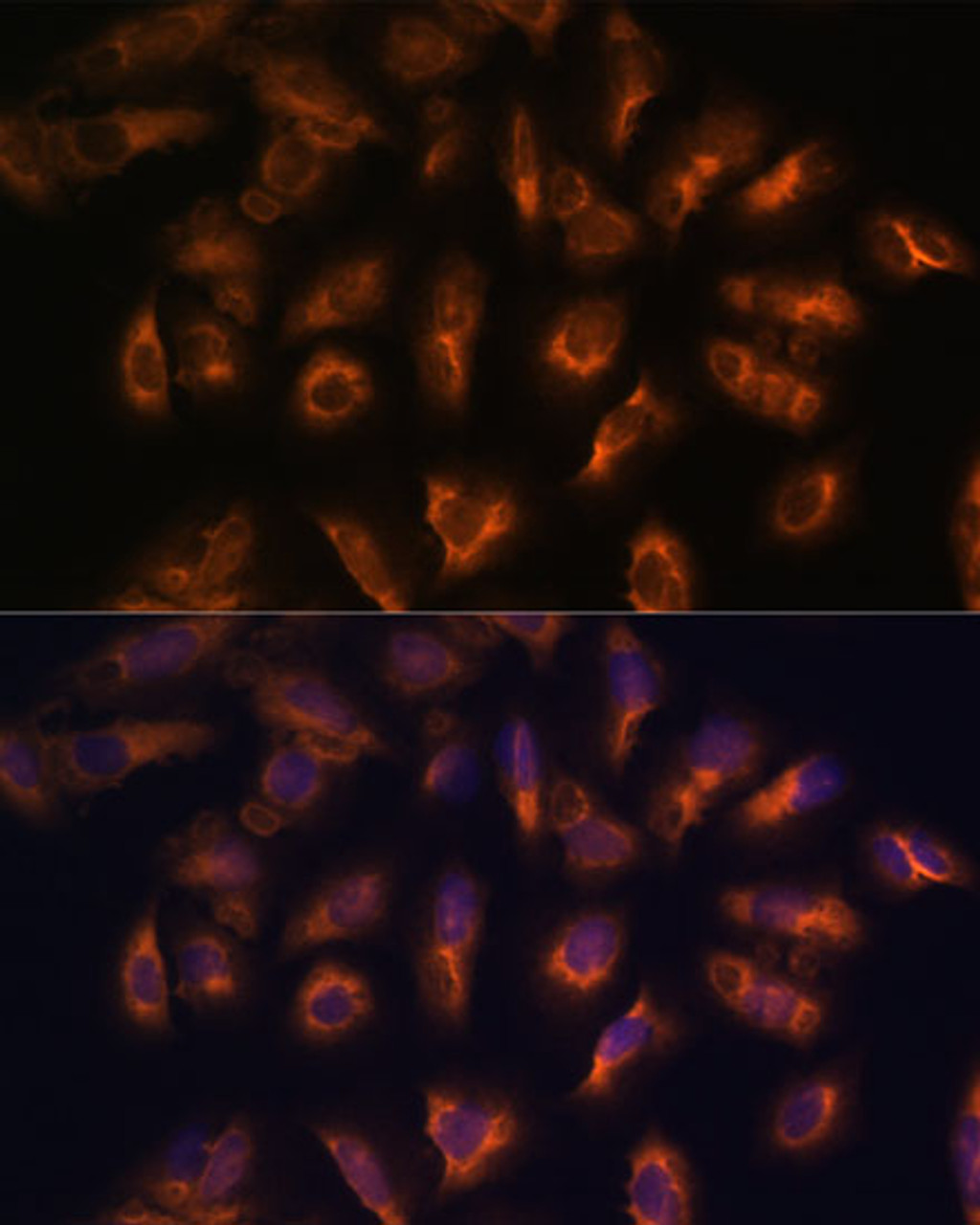 Immunofluorescence analysis of U-2 OS cells using SSTR2 Polyclonal Antibody at dilution of  1:100 (40x lens). Blue: DAPI for nuclear staining.